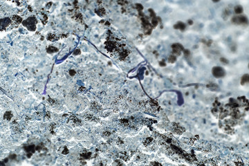 bacteria or cells under a microscope. Multiplication of bacteria or infection. Scientific experience. Microbes attacking cells