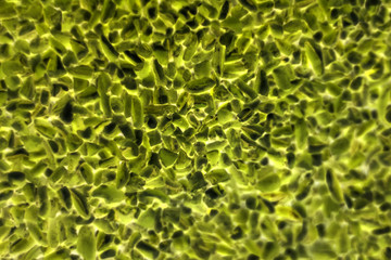 bacteria or cells under a microscope. Multiplication of bacteria or infection. Scientific experience. attacking cells
