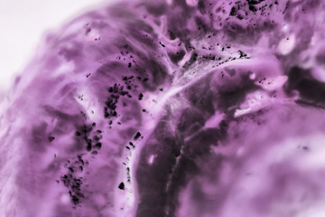 cancer cells under a microscope. Tissues affected by cancer cells under the microscope, Science....