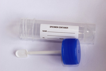 Fecal Sample Test for Disease Assessment and Diagnosis