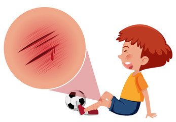 A boy injured from playing football