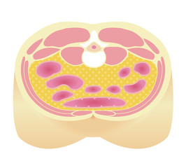 Type of obesity illustration . Abdominal sectional View (visceral fat ). 