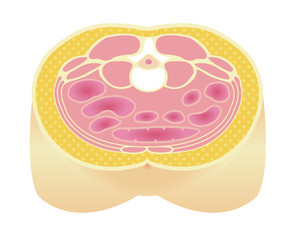 Type of obesity illustration . Abdominal sectional View (subcutaneous fat). 