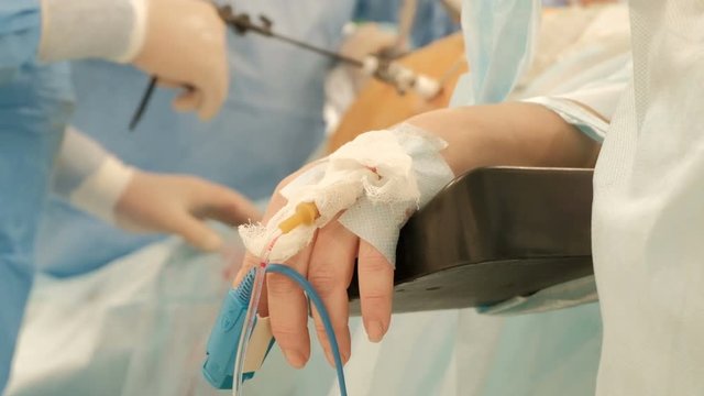 Endosurgery. The focus point of the camera moves from the patient's hand to the surgeon's hands. The operation in the hospital. Laparoscopic surgery. Close-up. Shallow depth of field.