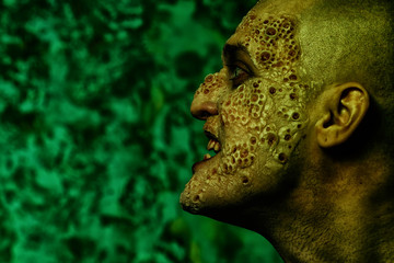 infected ugly scientist