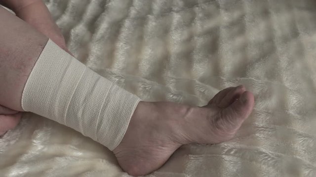 A woman bandages a sore leg with varicose veins, a special therapeutic elastic bandage