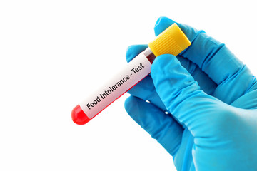 Test tube with blood sample for food intolerance test