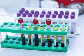 Patient blood samples. Preparation for biochemical examination of patients ' blood