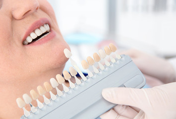 Dentist selecting patient's teeth color with palette in clinic, closeup