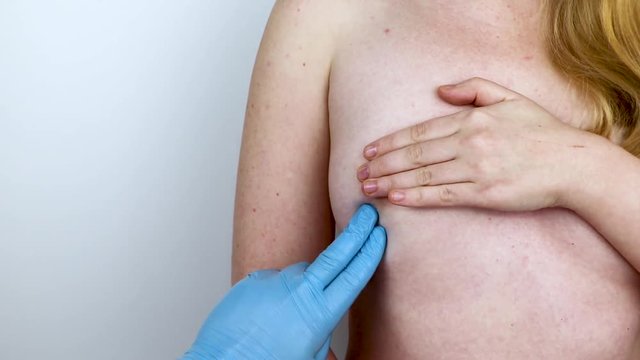 Doctor mammologist performs breast palpation. Examination of the chest by a doctor in a white office. The concept of women's health and longevity