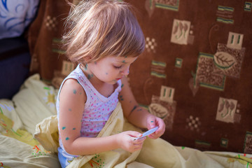 The child sick chicken pox sits in a bed and holds the thermometer in hand