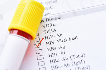 Blood sample for HIV RNA or HIV viral load test
