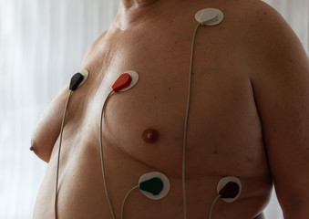 Pressure control. ECG according to Holter.