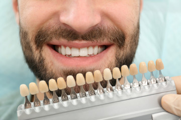 Dentist matching young man's teeth color with palette, closeup