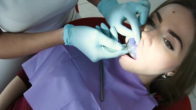 The dentist makes a cast of teeth for prosthetics from a special plastic mass of white and blue. orthopedic dentistry