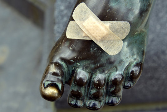 Pflaster an einer Kupferstatue am verletzten Fu&szlig; mit Wunde