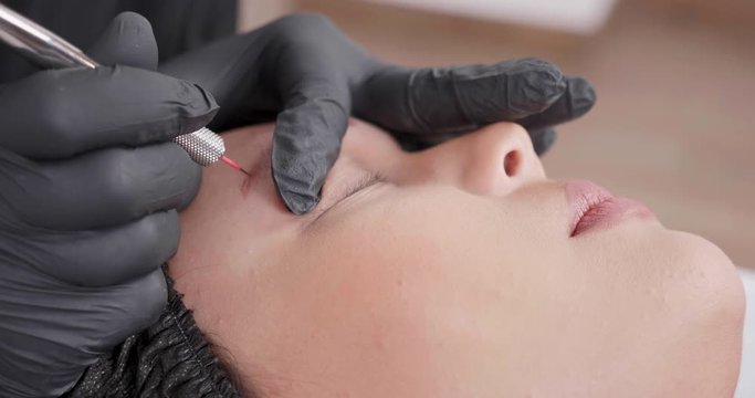Close up of a eyebrow tattoo removal technique performed by a beautician. Staccato motion of hand pulling the ink up to the surface of epidermis.