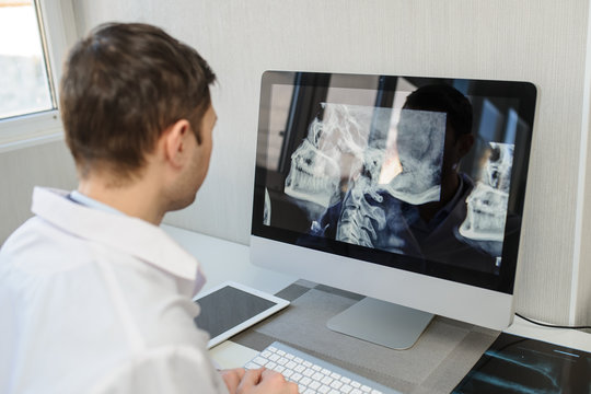 lateral view of a male radiologist examining neck x-rays (cervical vertebrae) on computer