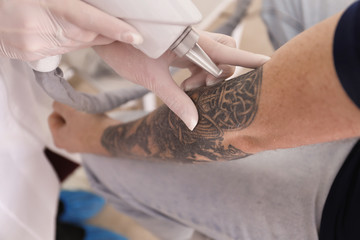 Cosmetologist with patient and professional tattoo removal laser in salon