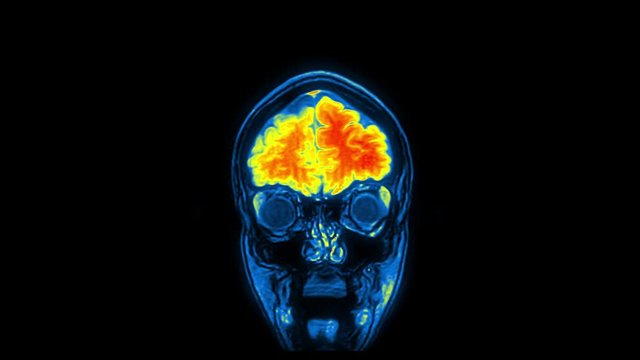 Computed medical tomography MRI upscaled scan of healthy young female head. Front view. Discrete slices. Red, yellow, blue on black background.