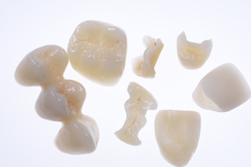 Keramikkronen, Vollkeramik, Inlay, Onlay