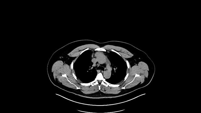 Diagnosis of magnetic resonance imaging. Detection of diseases in the early stages.