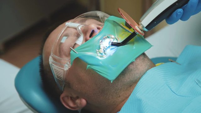 View of dental curing light using for teeth treatment. 4K