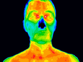 Thermographic image of a human face showing different temperatures in a range of colors from blue showing cold to red showing hot which can indicate inflammation. - 252474985