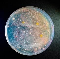Bacteria colonies in petri dish