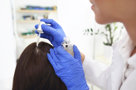 Łupież. Dermatolog nakłada lekarstwo na sk&oacute;rę głowy kobiety.