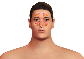 face of man with nasal sinuses inflamed with sinusitis. Allergic sinusitis and body malaise.