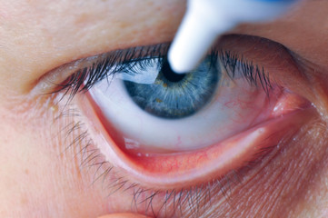 Instill eyedrops or ointment on eye.