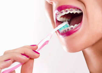 Closeup shot woman with dental braces washing teeth with toothbrush 