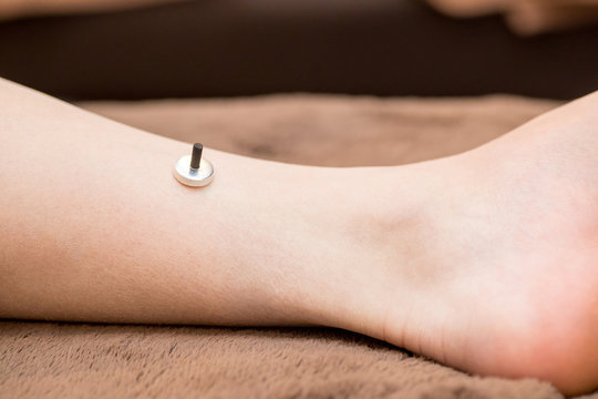 お灸をする女性