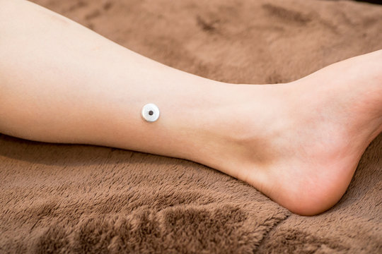 お灸をする女性