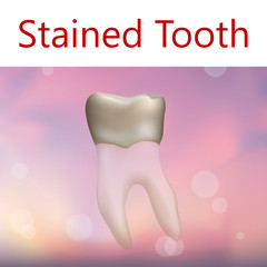 Stained Tooth. Vector realistic anatomy illustration. Pink abstract background.