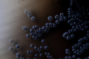 Colony characteristic of Actinomyces, Bacteria, yeast and Mold on selective media from soil samples for study in laboratory microbiology.