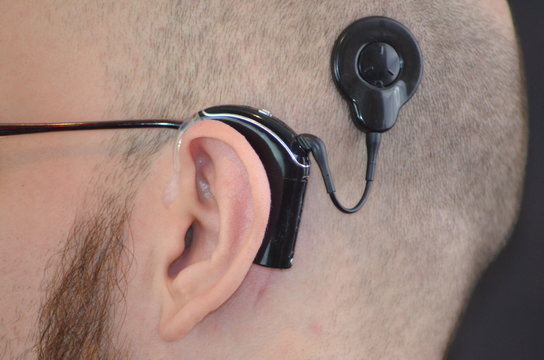 Cochlea-Implantat 011