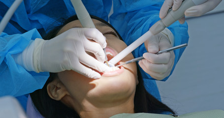 Asian Woman have dental check up in the clinic