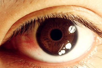 Sick red eye background