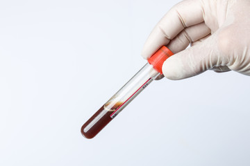 Doctor's hand with medical glove holds a blood probe