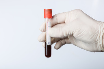Doctor's hand with medical glove holds a blood probe