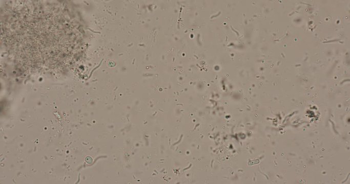 Bacteria type in wastewater under the microscope in laboratory.