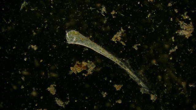 stentor ciliate - protozoa - off-axis illumination of microorganism in pond water under microscope unicellular organism