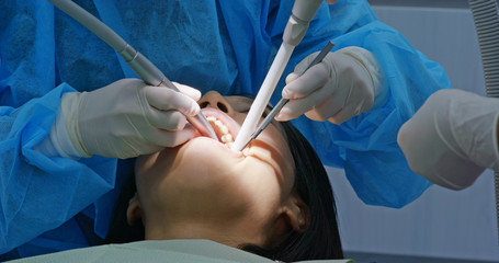 Woman wash teeth in the dental clinic