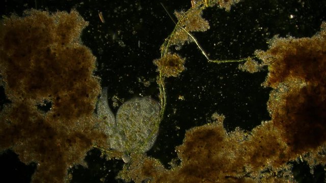 ciliate - protozoa - off-axis illumination of microorganism in pond water under microscope unicellular organism