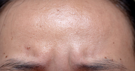 Close-up asian girl  with  frowning her forehead.