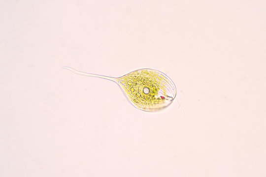 Phacus is a unicellular of the phylum Euglenozoa under the microscope.