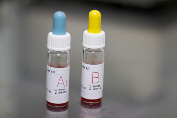 reagents to determine blood group. standard red blood cells. RBC. gel technology. Concept:...