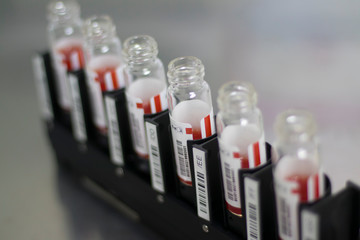 reagents to determine blood group. standard red blood cells. RBC. gel technology. Concept:...